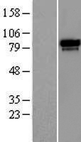 RAP80 (UIMC1) Human Over-expression Lysate