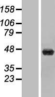 UPB1 Human Over-expression Lysate