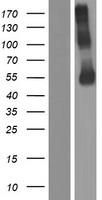 P2X2 (P2RX2) Human Over-expression Lysate