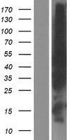 EVL Human Over-expression Lysate