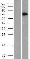 ZNF 639 (ZNF639) Human Over-expression Lysate