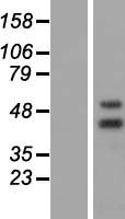 NR2E3 Human Over-expression Lysate