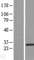 RNF141 Human Over-expression Lysate