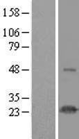 HSPC111 (NOP16) Human Over-expression Lysate