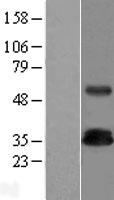 TRIM (TRAT1) Human Over-expression Lysate
