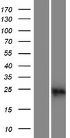 CABP2 Human Over-expression Lysate