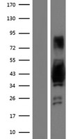 AKAP7 Human Over-expression Lysate