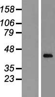 CXXC5 Human Over-expression Lysate