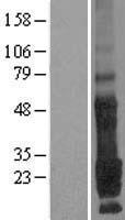 TMEM9 Human Over-expression Lysate