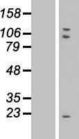 TMEM85 (EMC4) Human Over-expression Lysate