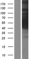 C8orf30A (HGH1) Human Over-expression Lysate