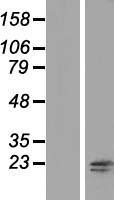 RNF181 Human Over-expression Lysate