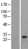 RAB8B Human Over-expression Lysate