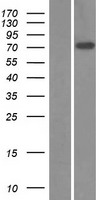 ZNF571 Human Over-expression Lysate