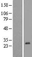 ZNF581 Human Over-expression Lysate