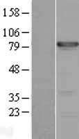 TBX3 Human Over-expression Lysate
