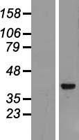 Archaemetzincin 2 (AMZ2) Human Over-expression Lysate