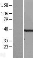 ETS1 associated protein II (TDP2) Human Over-expression Lysate
