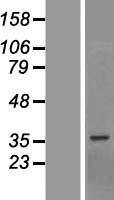 BCCIP Human Over-expression Lysate