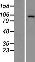 HDAC7 Human Over-expression Lysate