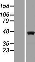 PAX5 Human Over-expression Lysate