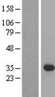 SIX2 Human Over-expression Lysate