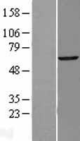 TBX22 Human Over-expression Lysate