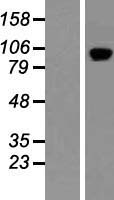 PDE11A Human Over-expression Lysate