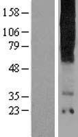 TAS2R16 Human Over-expression Lysate
