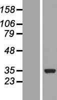 COQ3 Human Over-expression Lysate