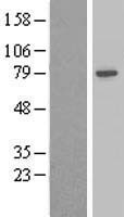 Adducin 2 (ADD2) Human Over-expression Lysate