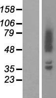 Adducin 2 (ADD2) Human Over-expression Lysate