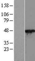 Cytohesin 2 (CYTH2) Human Over-expression Lysate