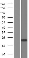 DNA Polymerase epsilon (POLE3) Human Over-expression Lysate