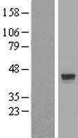 ZNF821 Human Over-expression Lysate