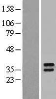 Lymphocyte Antigen 6 Complex (LY6K) Human Over-expression Lysate