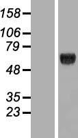 KLHDC4 Human Over-expression Lysate