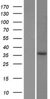 EPDR1 Human Over-expression Lysate