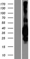 MED29 Human Over-expression Lysate