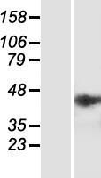 NSMCE4A Human Over-expression Lysate