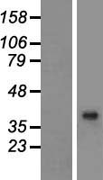 BHMT2 Human Over-expression Lysate