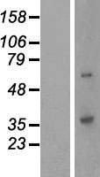 QPCTL Human Over-expression Lysate