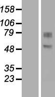 GDPD2 Human Over-expression Lysate