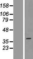 PAQR5 Human Over-expression Lysate