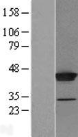 THUMPD1 Human Over-expression Lysate