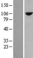 TTC27 Human Over-expression Lysate