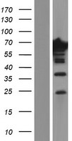 EPS8L1 Human Over-expression Lysate