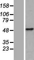CWC25 Human Over-expression Lysate