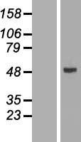 CYP2W1 Human Over-expression Lysate