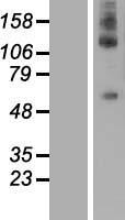 DEPDC1 Human Over-expression Lysate